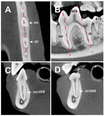 Localization of the First Mandibular Molar Roots in Relationship to the Mandibular Canal in Small Breed Dogs—A Tomography Imaging Study